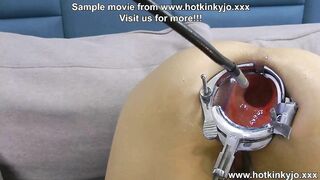 Hotkinkyjo XO speculum and deep anal abbys travel with endoscope camera