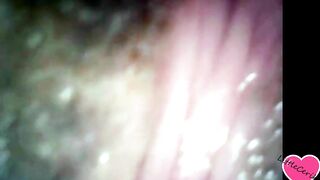 LittleCerika View Inside My pussy, endoscope